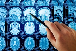 Photo of a brain scan